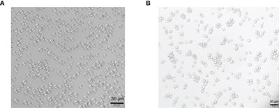 Dynamic changes in human THP-1-derived M1-to-M2 macrophage polarization during Thelazia callipaeda MIF induction